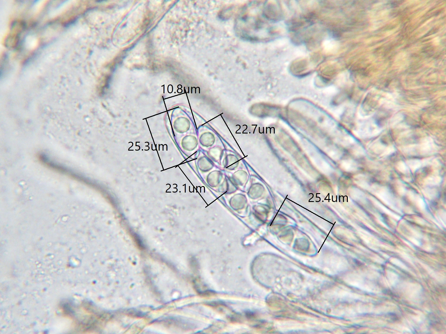 Octospora axillaris var. axillaris – Bryophilous fungi